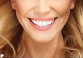 Teeth Whitening