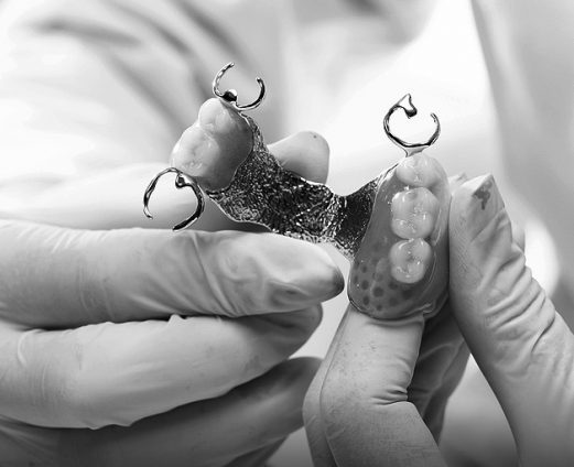 Dental Prosthodontics Services