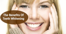 The Benefits Of Teeth Whitening