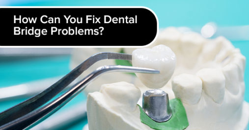 How Can You Fix Dental Bridge Problems?