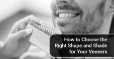 How to Choose the Right Shape and Shade for Your Veneers