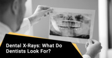 Dental X-Rays: What Do Dentists Look For?