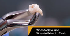 Tooth extraction tips