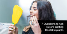 7 Questions to Ask Before Getting Dental Implants