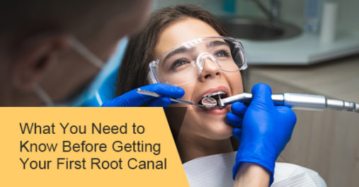 Things you need to know before getting your first root canal