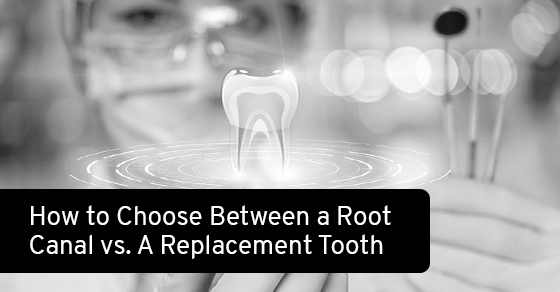 How to choose between a root canal vs. a replacement tooth