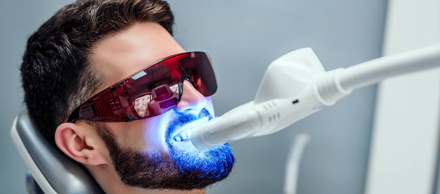 Teeth Whitening Bleaching Service in Oakville