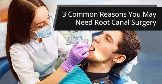 3 common reasons you May need root canal surgery