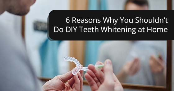 6 reasons why you shouldn’t do DIY teeth whitening at home