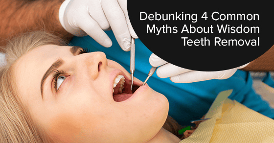 Debunking 4 common myths about wisdom teeth removal