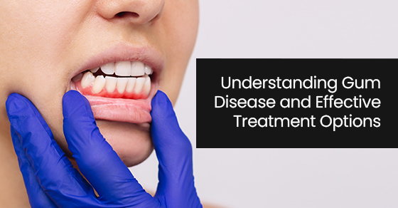 Understanding gum disease and effective treatment options